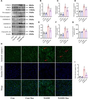 Sesamin ameliorates nonalcoholic steatohepatitis through inhibiting hepatocyte pyroptosis in vivo and in vitro